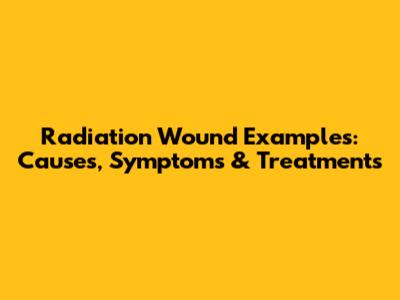 Radiation Wound Examples: Causes, Symptoms & Treatments
